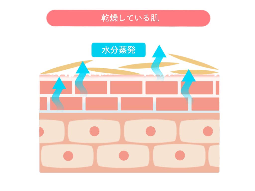 乾燥している肌のモデル