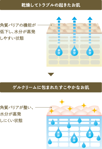 乾燥してトラブルの起きた肌とゲルクリームに包まれた健やかな肌の比較