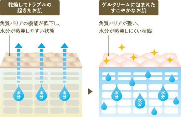 乾燥してトラブルの起きた肌とゲルクリームに包まれた健やかな肌の比較